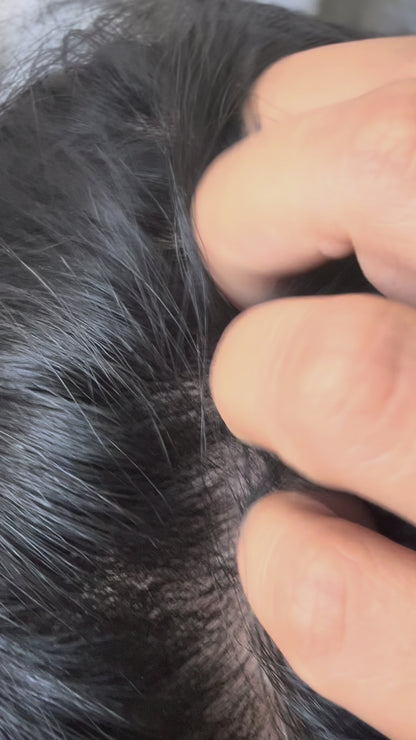 Shampoo Caspa y Psoriasis